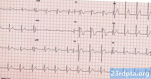EKG: Hva er det og hvorfor betyr det noe?
